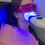 Teeth Whitening