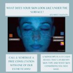 FREE SKIN SCOPE
